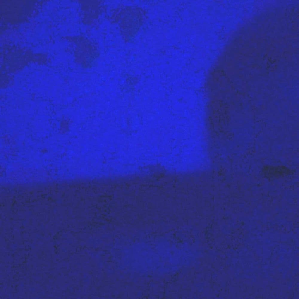 FROSTBITE