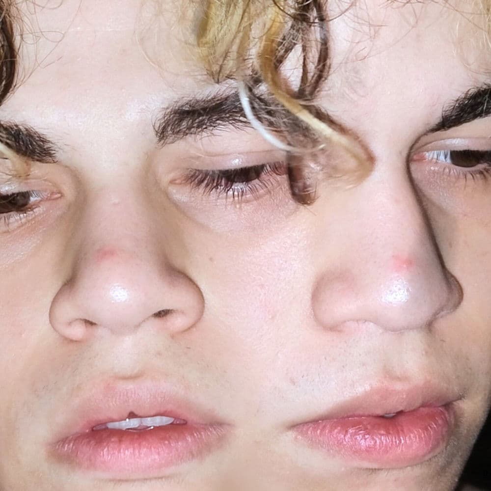 EU QUERIA SER UM (SIAMÊS)